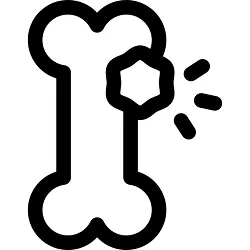 تراکم استخوان