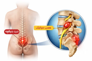 درد دنبالچه: علت‌ها و عوامل ایجادکننده