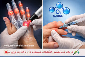 درمان درد مفصل انگشتان دست