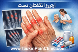 ارتروز انگشتان دست: علائم، علل و بهترین روش‌های درمان