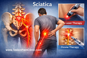 سیاتیک: علل، علائم و درمان غیرجراحی مؤثر