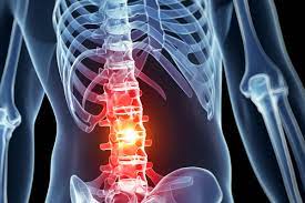 Spinal cord injuries