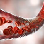 اوزون تراپی چیست و چگونه انجام می‌شود؟