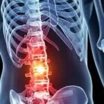 آسیب‌های نخاعی: دلایل، انواع و روش‌های درمان