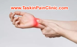 سندروم تونل کارپال | علائم، علل و روش‌های درمان مؤثر