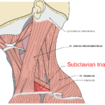 بلاک شبکه بازویی (Brachial plexus) با روش سوپراکلاویکولار (Supraclavicular) تحت گاید سونوگرافی