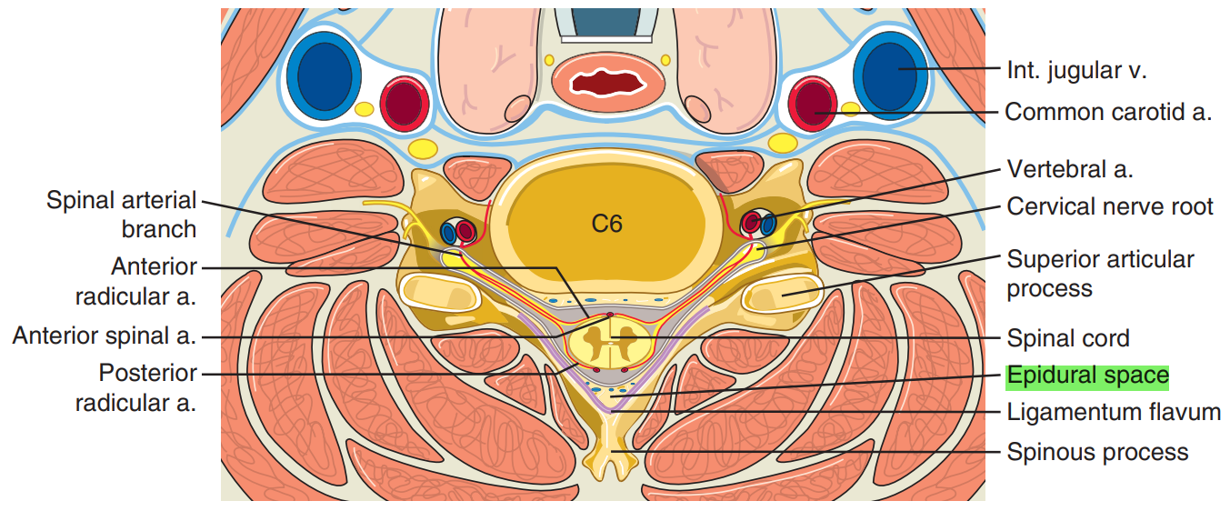 Cervical epidural(1)