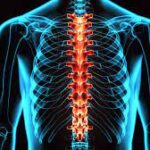 بلاک اپیدورال توراسیک (Thoracic، سینه ای) با روش پارامدین (Paramedian) تحت گاید فلوروسکوپی