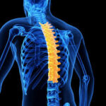 بلاک اپیدورال توراسیک (Thoracic، سینه ای) با روش پارامدین (Paramedian) تحت گاید سونوگرافی