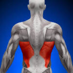 بلاک اپیدورال توراسیک با روش پاراورتبرال (Paravertebral) تحت گاید سونوگرافی