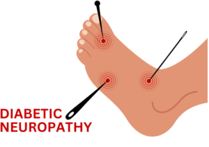 شیوع نوروپاتی اعصاب محیطی