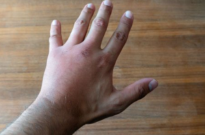 اپیدمیولوژی