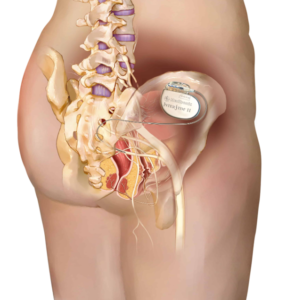 نوروماجولیشن