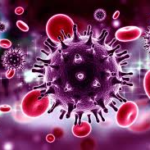 سندروم های درد مرتبط با HIV