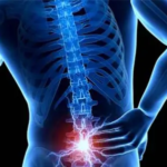 اختلالات درد کمر (low back pain disorders)