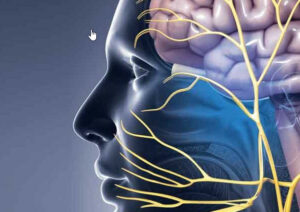 Trigeminal Neuralgia