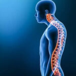 کیفوز چیست؟ علل، علائم، تشخیص و درمان قوز کمر