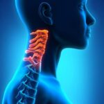 دیسک و آرتروز گردن؛ علت، علائم، تشخیص و درمان
