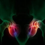 نورالژی عصب پودندال (Pudendal Neuralgia): علت، علائم و درمان