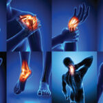 درد مزمن بدون دلیل مشخص (Idiopathic Chronic Pain)
