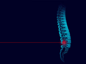 لیزر دیسک کمر