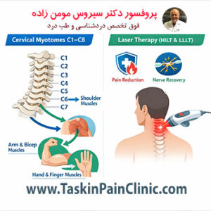 میوتوم‌های گردنی و درمان آن با لیزر