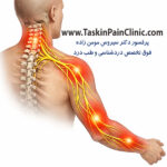 ارتباط درد گردن و دست: از فشار عصبی تا مشکلات ستون فقرات
