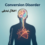 اختلال تبدیلی-پروفسور دکتر سیروس مومن زاده-فوق تخصص دردشناسی